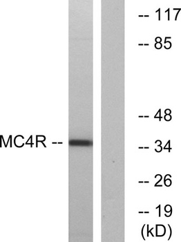 MC4-R rabbit pAb Antibody