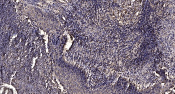 Mcl-1 (phospho Ser159) rabbit pAb