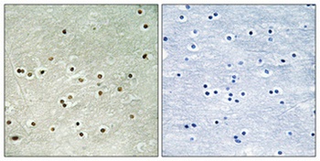 MCM4 (phospho Ser54) rabbit pAb Antibody