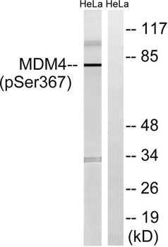 MDMX (phospho Ser367) rabbit pAb Antibody