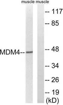 MDMX rabbit pAb Antibody