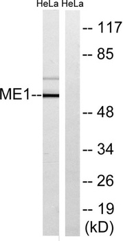 Malic enzyme 1 rabbit pAb Antibody