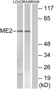 ME2 rabbit pAb Antibody