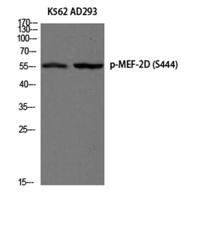 MEF-2D (phospho Ser444) rabbit pAb Antibody