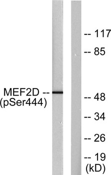 MEF-2D (phospho Ser444) rabbit pAb Antibody