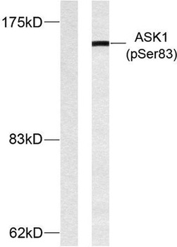 ASK 1 (phospho Ser83) rabbit pAb Antibody