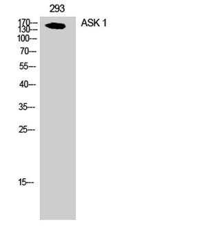 ASK 1 rabbit pAb Antibody