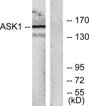 ASK 1 rabbit pAb Antibody