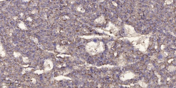 Met (phospho Tyr1356) rabbit pAb Antibody