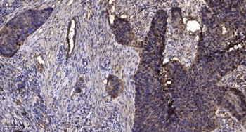 MGST1 rabbit pAb Antibody