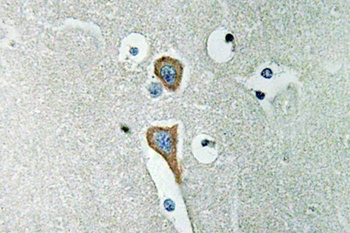 AChE rabbit pAb Antibody
