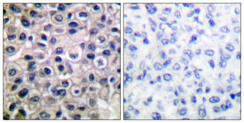 MMP-14 rabbit pAb Antibody
