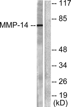 MMP-14 rabbit pAb Antibody