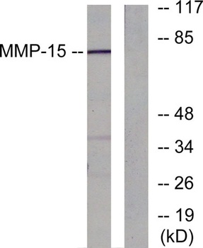 MMP-15 rabbit pAb Antibody