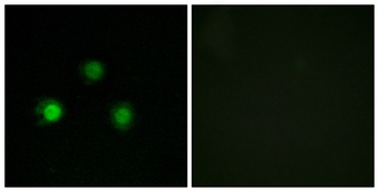 MSH2 rabbit pAb Antibody