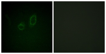 Moesin/Ezrin/Radixin (phospho Thr558) rabbit pAb Antibody