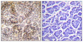 Moesin/Ezrin/Radixin (phospho Thr558) rabbit pAb Antibody