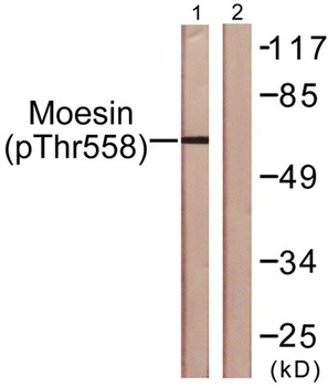 Moesin/Ezrin/Radixin (phospho Thr558) rabbit pAb Antibody
