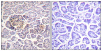 Moesin/Ezrin/Radixin rabbit pAb Antibody