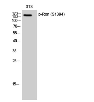 Ron (phospho Ser1394) rabbit pAb Antibody