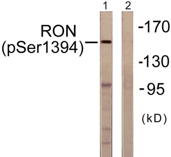 Ron (phospho Ser1394) rabbit pAb Antibody