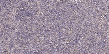 Ron (phospho Ser1394) rabbit pAb Antibody