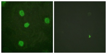 B-Myb (phospho Ser577) rabbit pAb Antibody