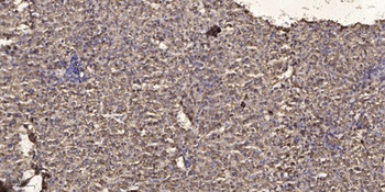 MYL6 rabbit pAb Antibody