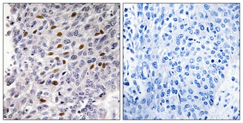 ATF-1 rabbit pAb Antibody