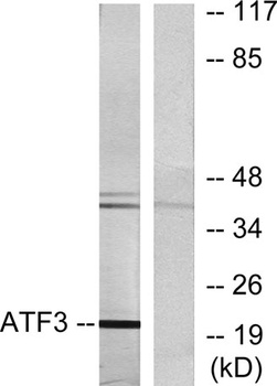 ATF-3 rabbit pAb Antibody