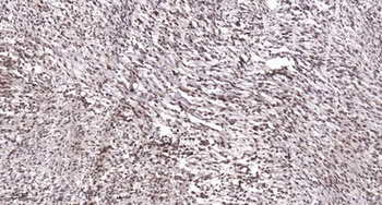 ATF-3 rabbit pAb Antibody