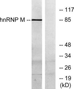 hnRNP M rabbit pAb Antibody