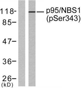 Nibrin (phospho Ser343) rabbit pAb Antibody