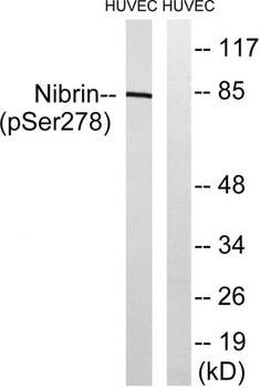 Nibrin (phospho Ser278) rabbit pAb Antibody