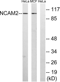 NCAM2 rabbit pAb Antibody