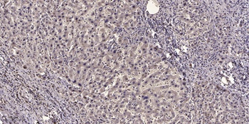NCAM2 rabbit pAb Antibody