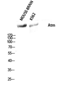 Atm rabbit pAb Antibody