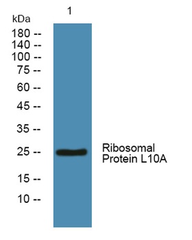 Ribosomal Protein L10A rabbit pAb Antibody