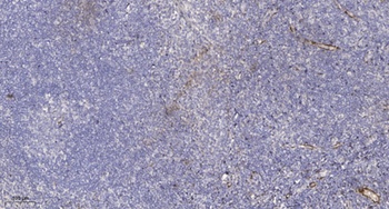 Ribosomal Protein L10A rabbit pAb Antibody