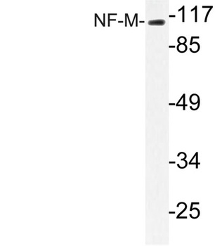 NF-M rabbit pAb Antibody