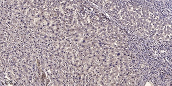 NF-M rabbit pAb Antibody