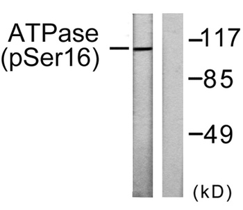 Na+/K+-ATPase α1 (phospho Ser16) rabbit pAb Antibody
