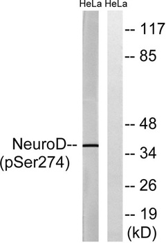 Neuro D (phospho Ser274) rabbit pAb Antibody