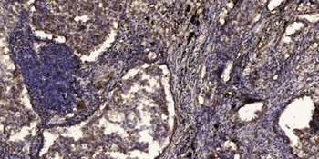 Neuro D (phospho Ser274) rabbit pAb Antibody