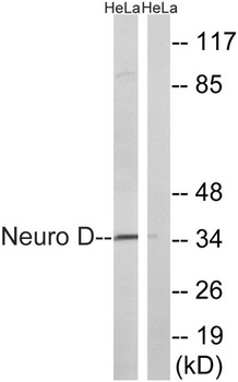 Neuro D rabbit pAb Antibody