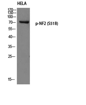 NF2 (phospho Ser518) rabbit pAb Antibody