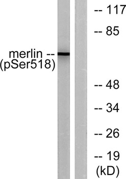 NF2 (phospho Ser518) rabbit pAb Antibody