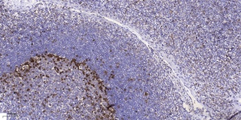 NF2 (phospho Ser518) rabbit pAb Antibody