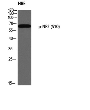 NF2 (phospho Ser10) rabbit pAb Antibody