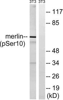 NF2 (phospho Ser10) rabbit pAb Antibody